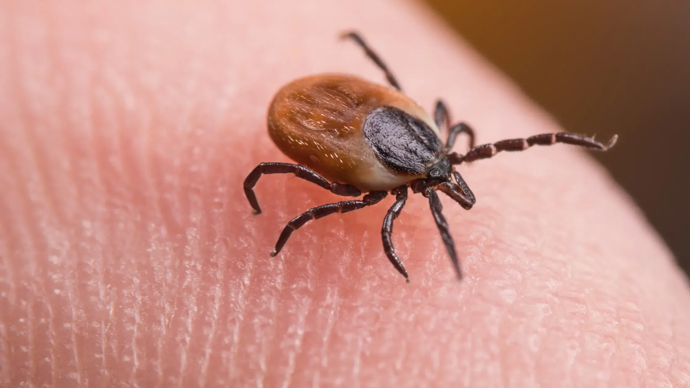 Tick-Borne Diseases: Babesiosis